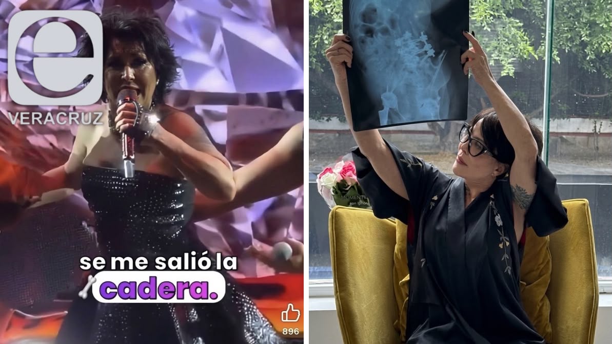 Alejandra Guzmán demanda a sujeto que intentó moverle la pierna en Veracruz