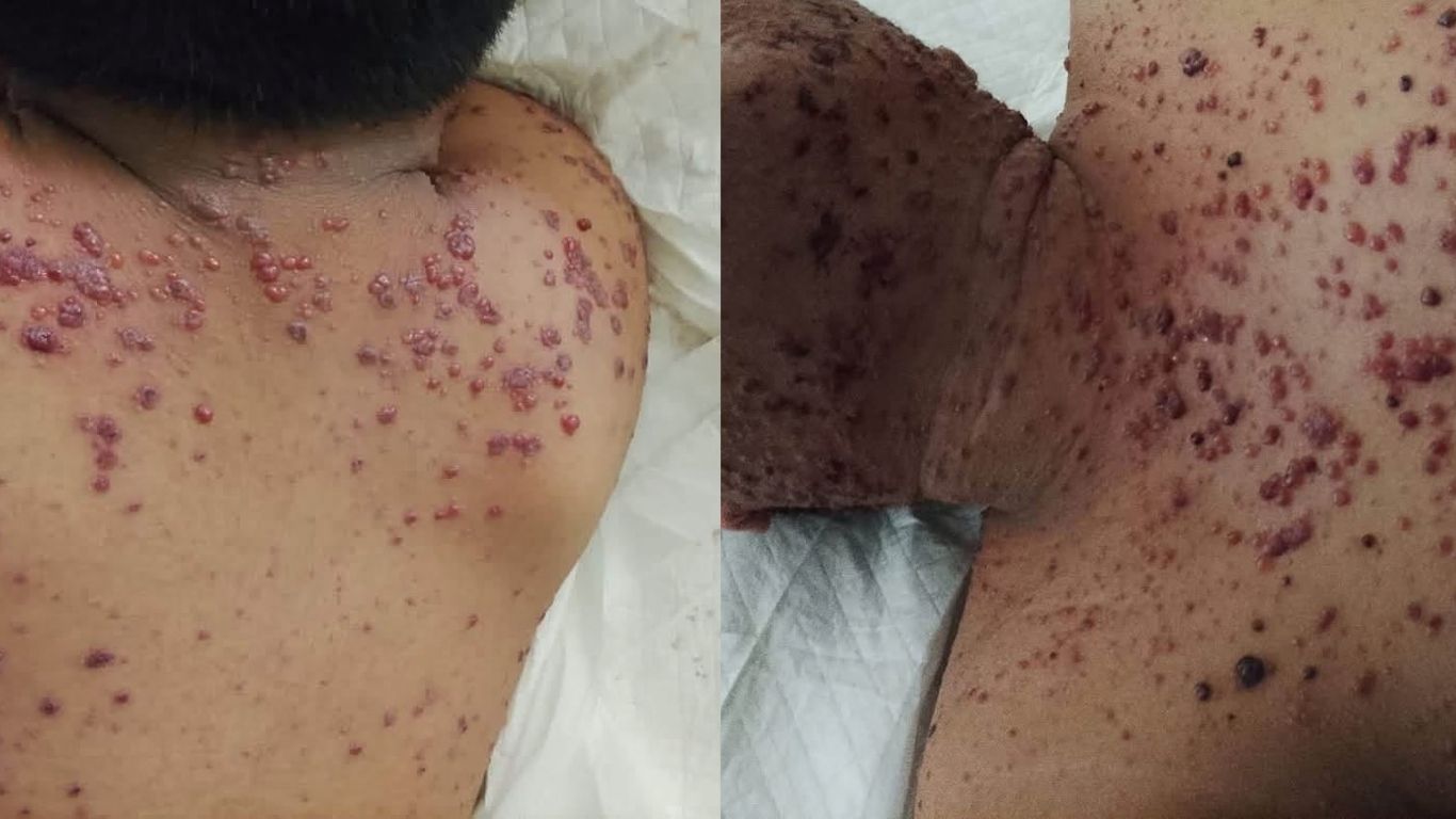 Khaled, de 14 años, fallece en el IMSS y familia acusa presuntas omisiones