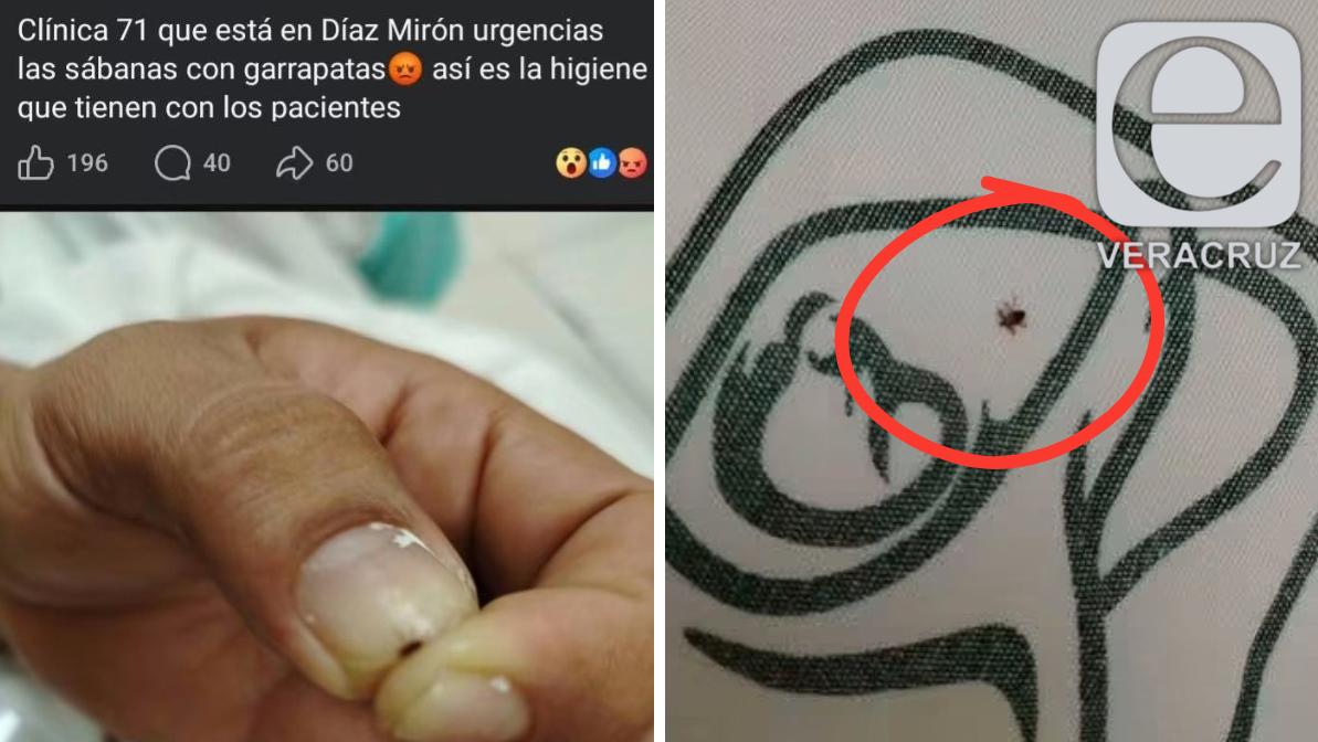 Reportan garrapata en IMSS 71 de Veracruz; clínica lo niega