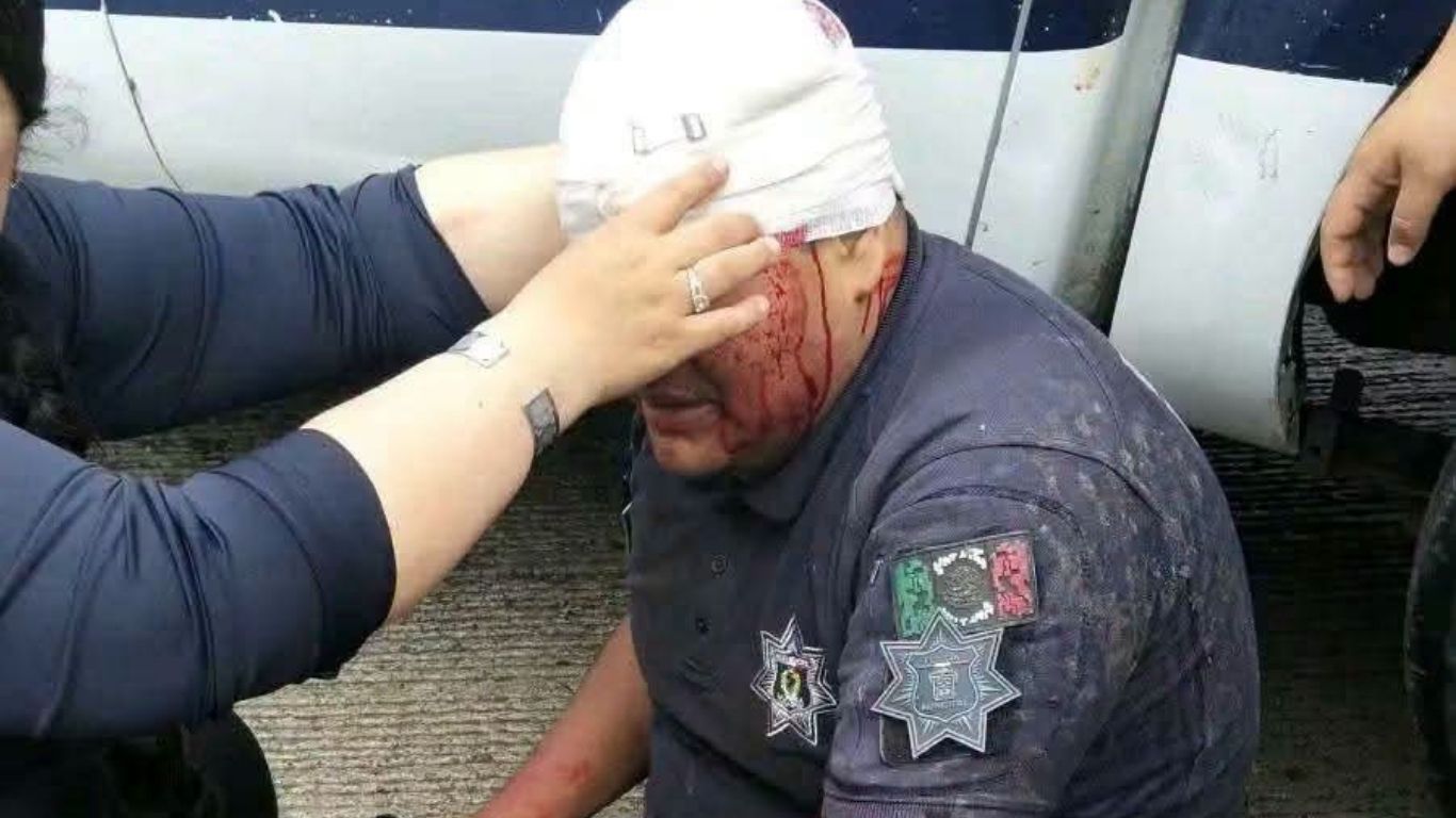 Choque de patrulla en La Perla deja dos policías lesionados